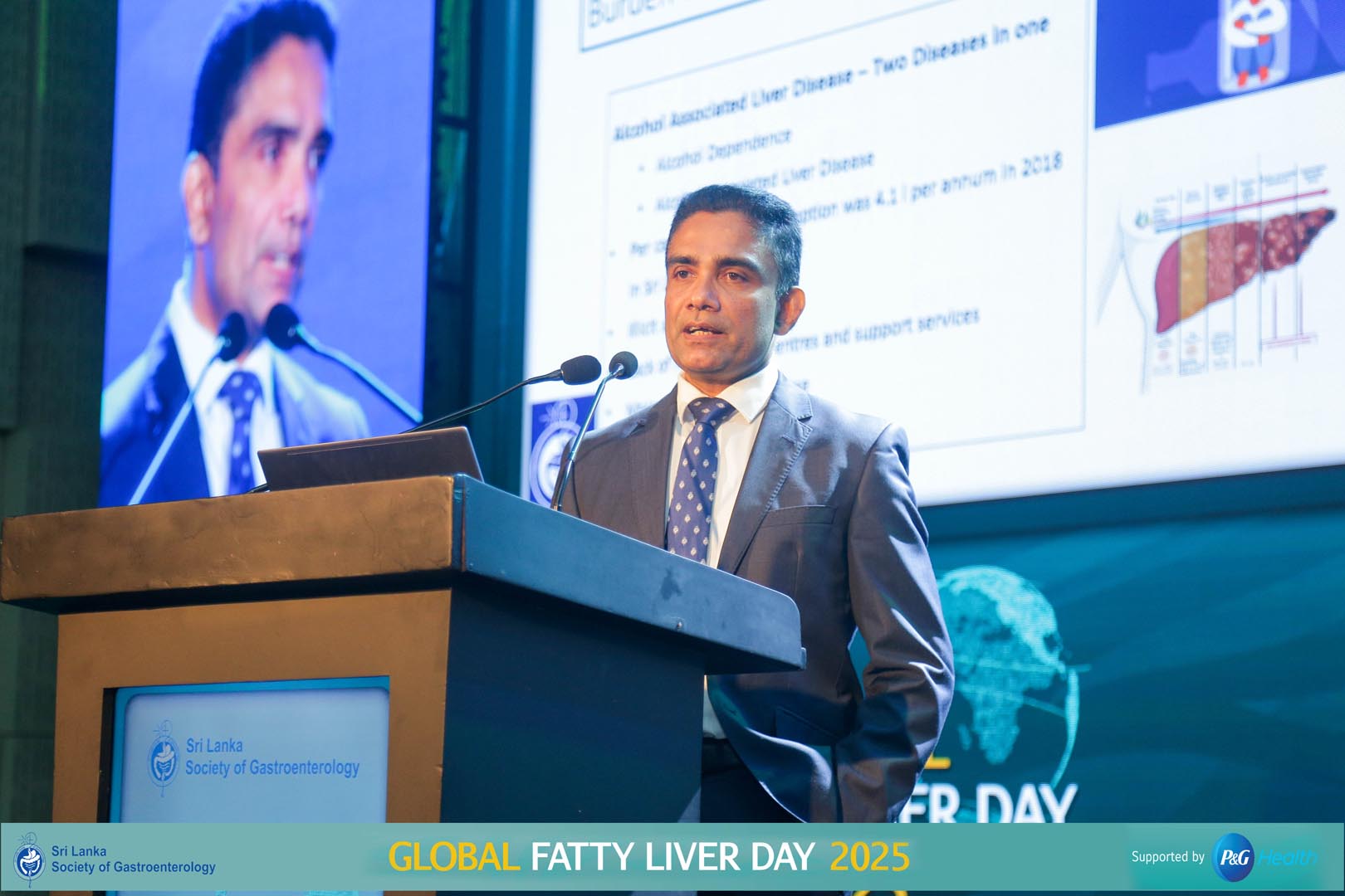 SLSG_Global_Fatty_Liver_Day_2025 (103)