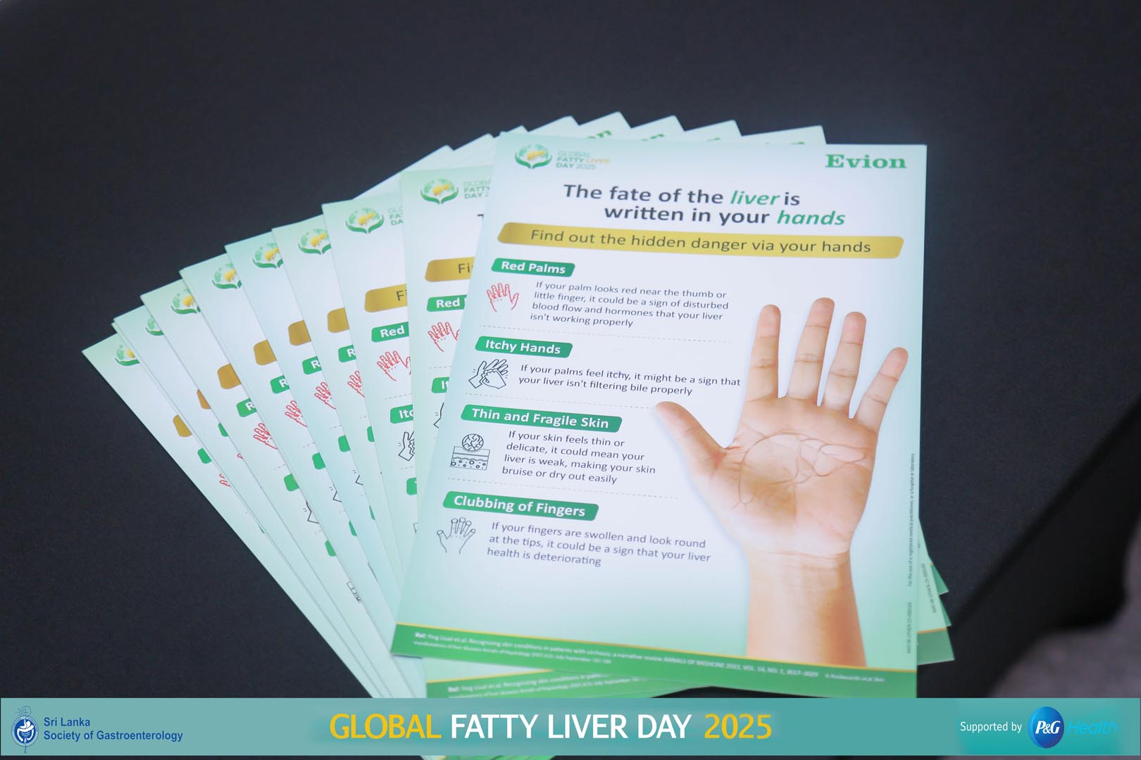 SLSG_Global_Fatty_Liver_Day_2025 (9)